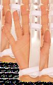 Finger Extension Splint